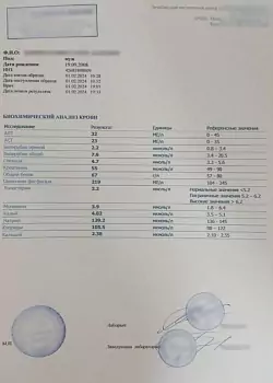 Купите биохимический анализ крови (формы 228/у) в Москве.